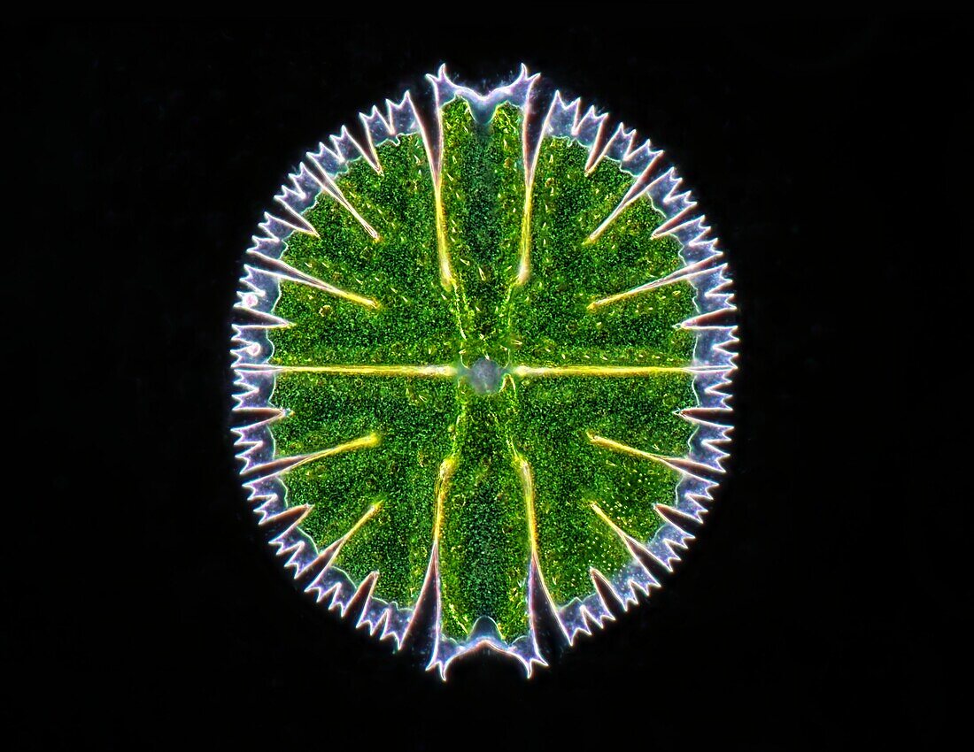 Micrasterias desmid, light micrograph