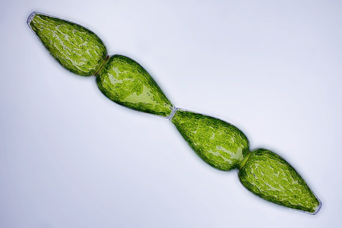 Pleurotaenium ovatum desmid cell division, light micrograph