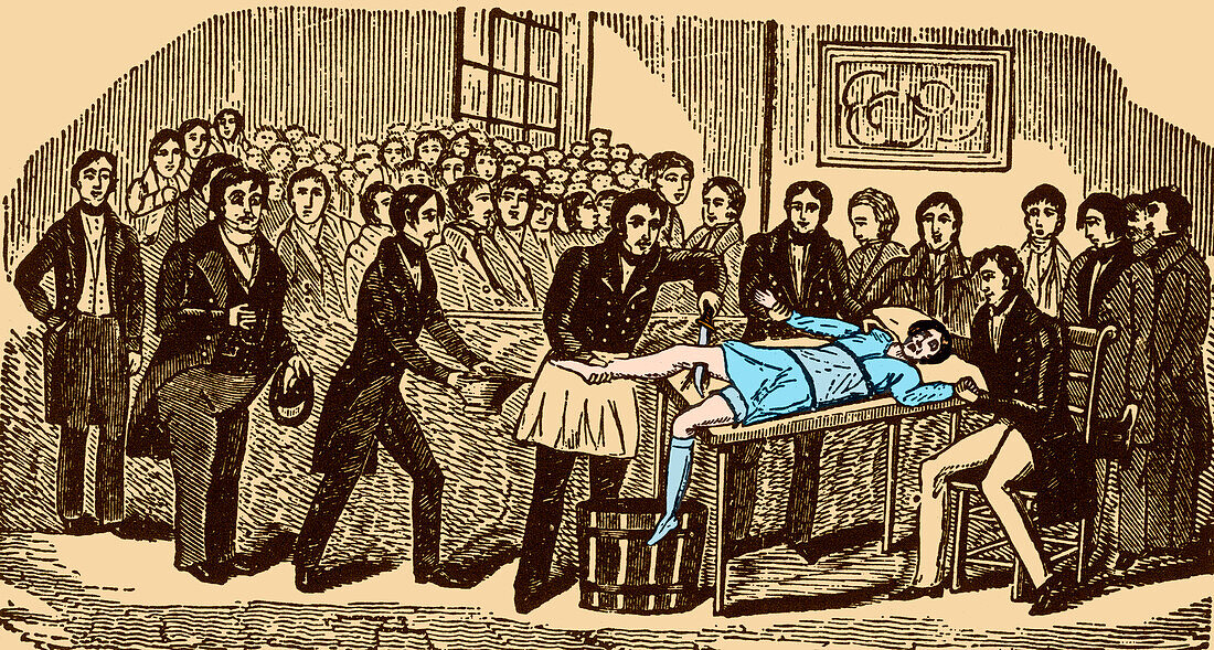 Surgery without Anaesthesia, pre-1840s