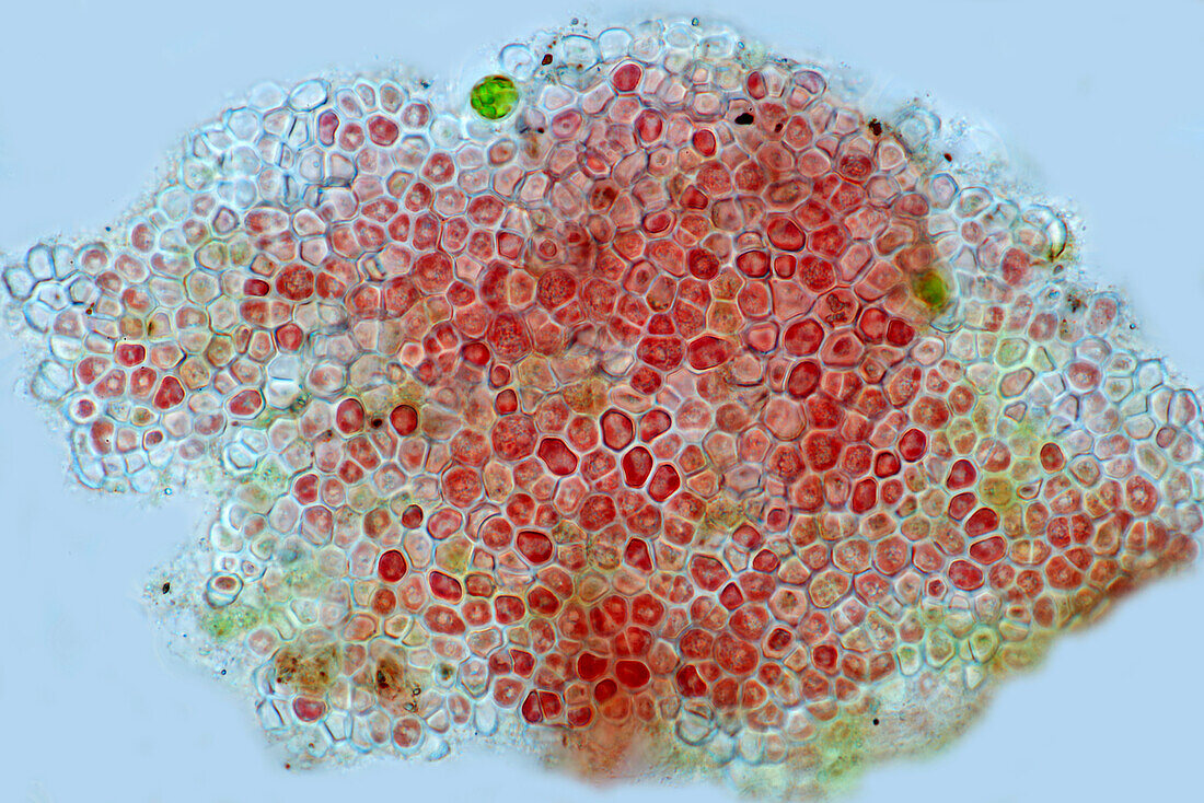 Hildenbrandia sp. freshwater red algae, light micrograph