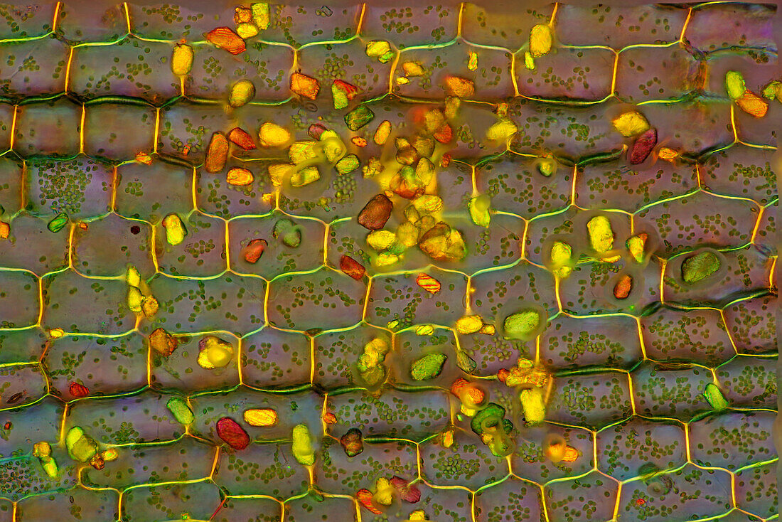 Mineral grains on Canadian pondweed, light micrograph
