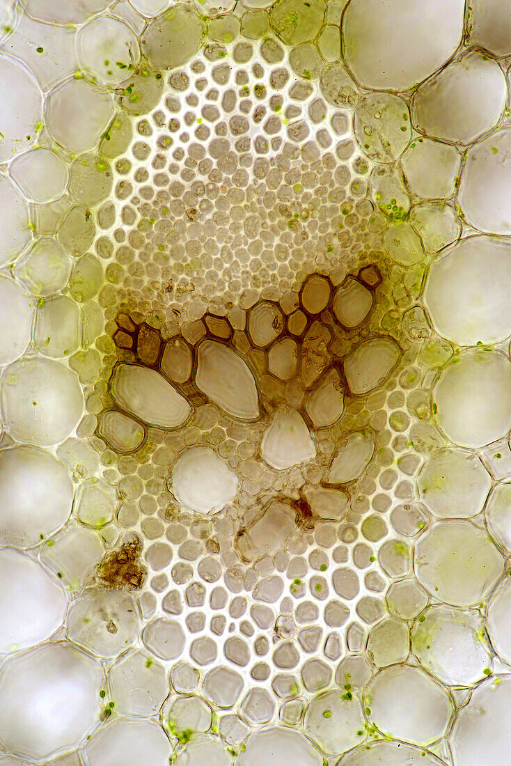 Plantain lily vascular bundle, light micrograph