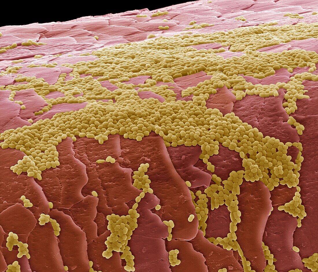 Skin bacteria on hair, SEM