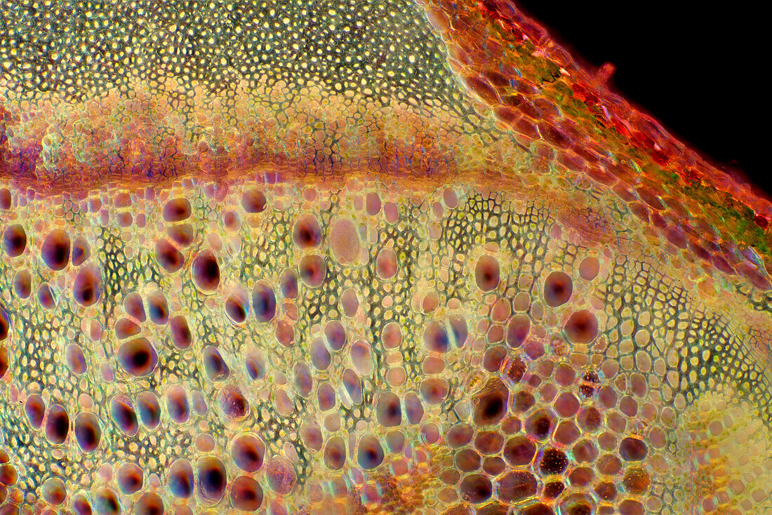 Chenopodium sp. cells with air bubbles, light micrograph