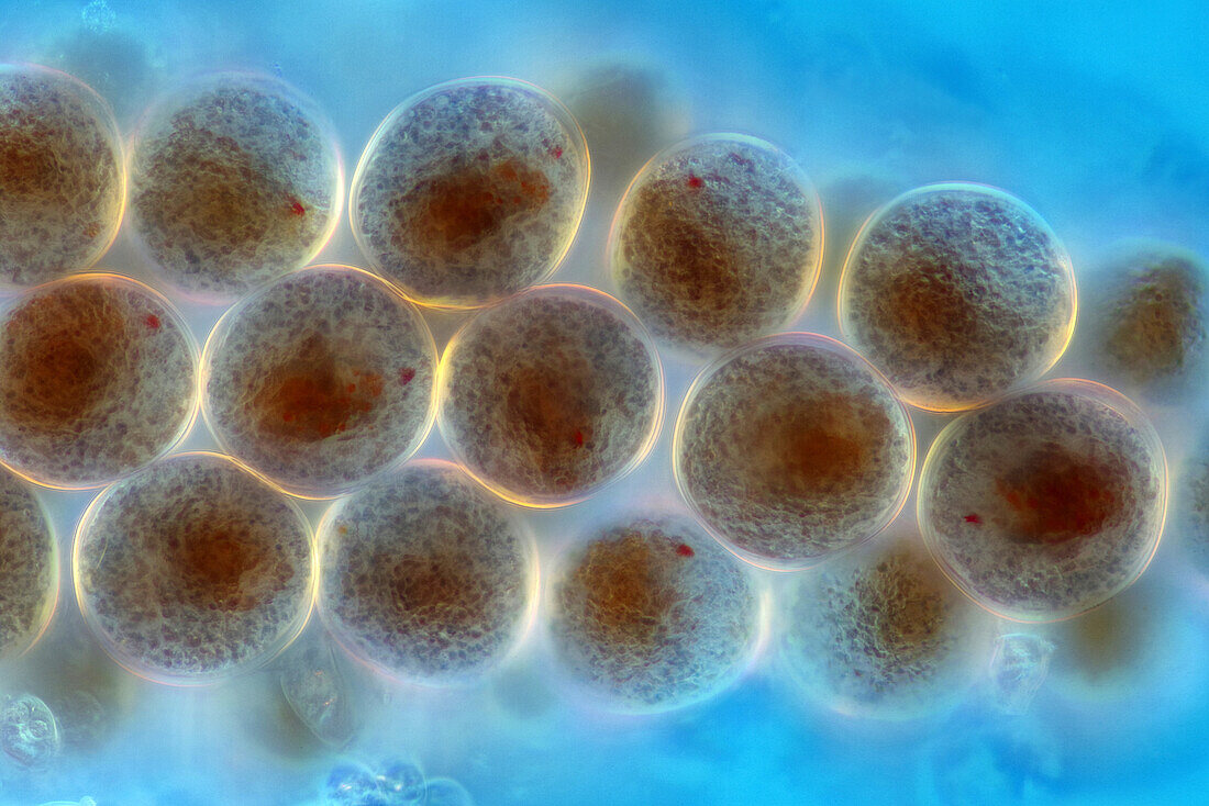 Copepod eggs, polarised light micrograph