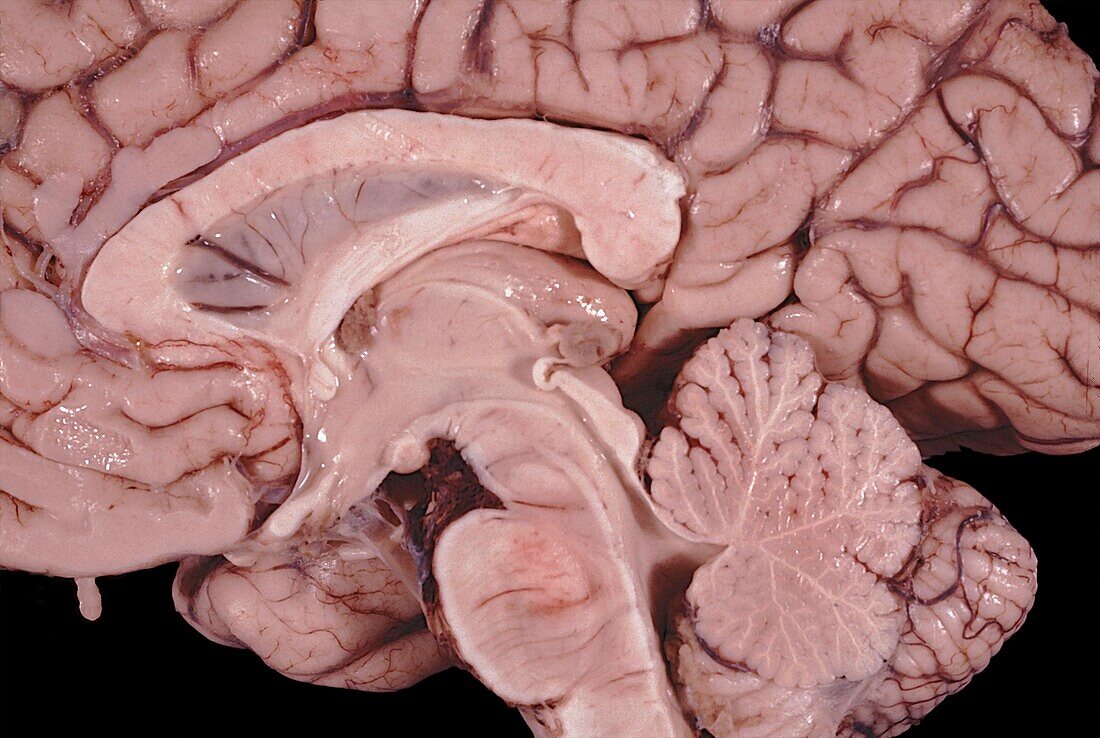 Diencephalon of the human brain