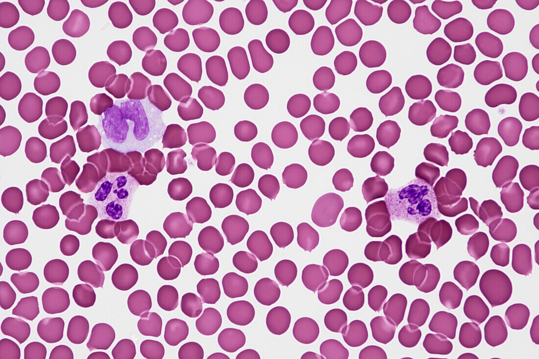 Blood smear, light micrograph