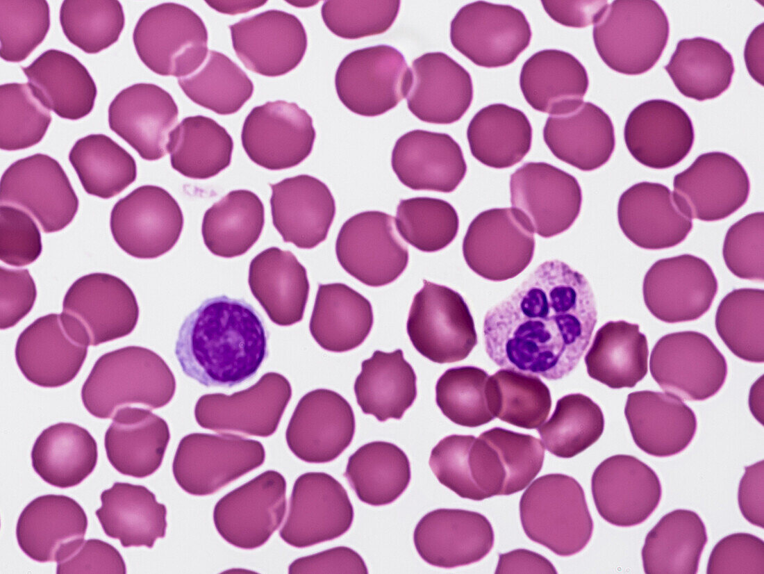 Blood smear, light micrograph