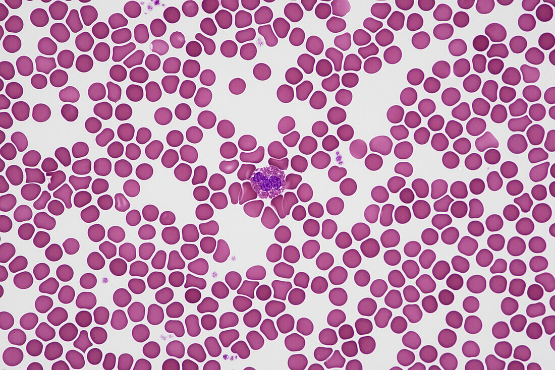 Blood smear, light micrograph