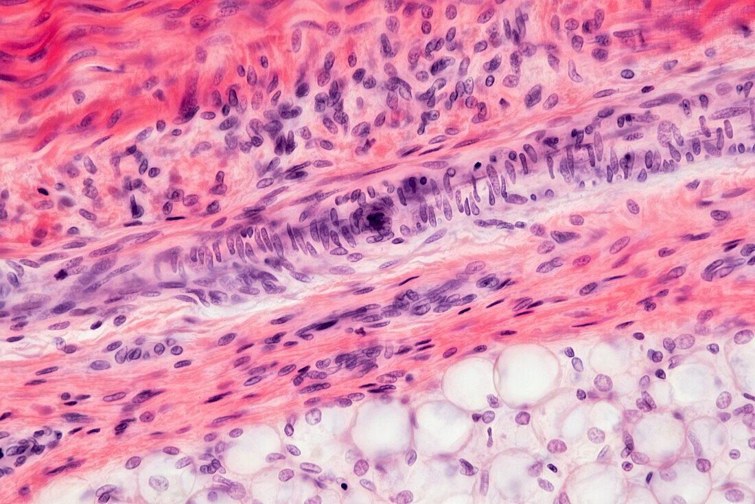 Arteriole wall, light micrograph