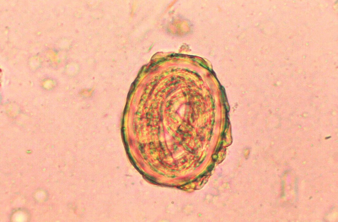 Fertilised Ascaris lumbricoides egg, light micrograph
