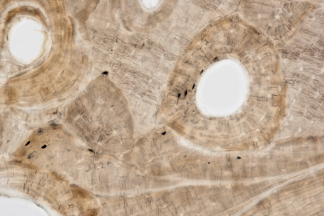 Compact bone, light micrograph
