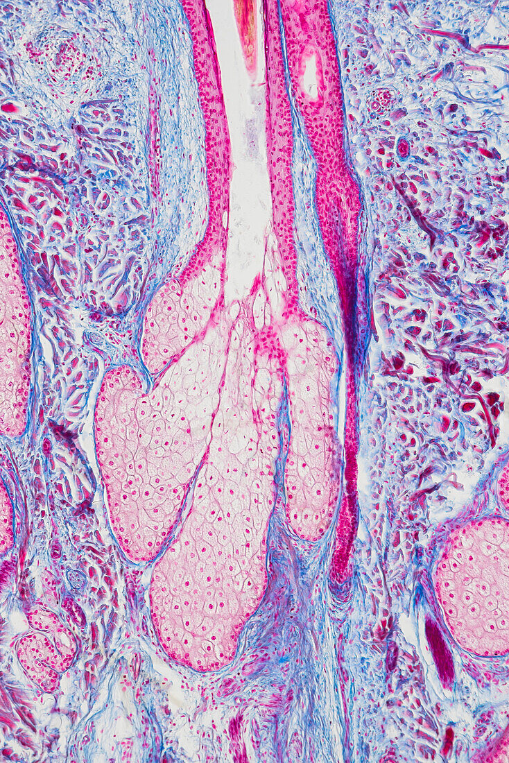 Hair follicle sebaceous gland, light micrograph