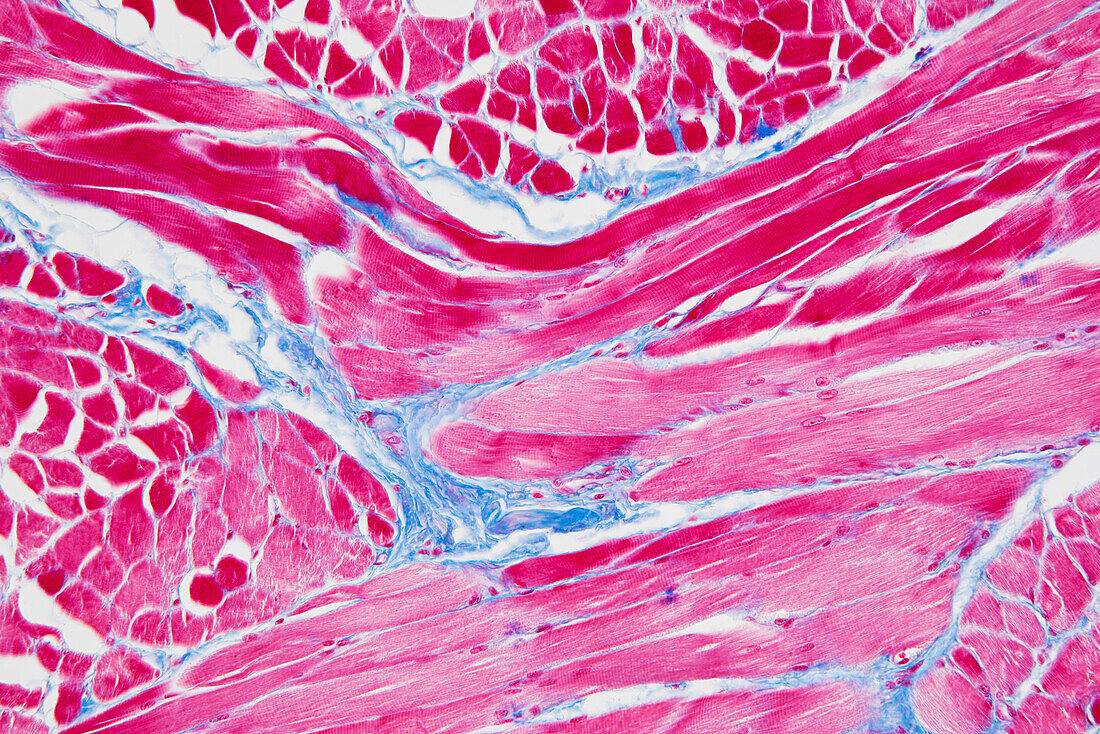 Tongue muscle fibres, light micrograph