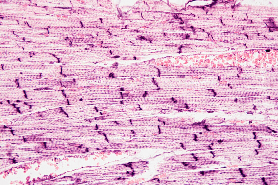 Heart muscle, light micrograph