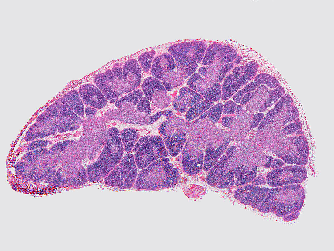 Thymus gland, light micrograph
