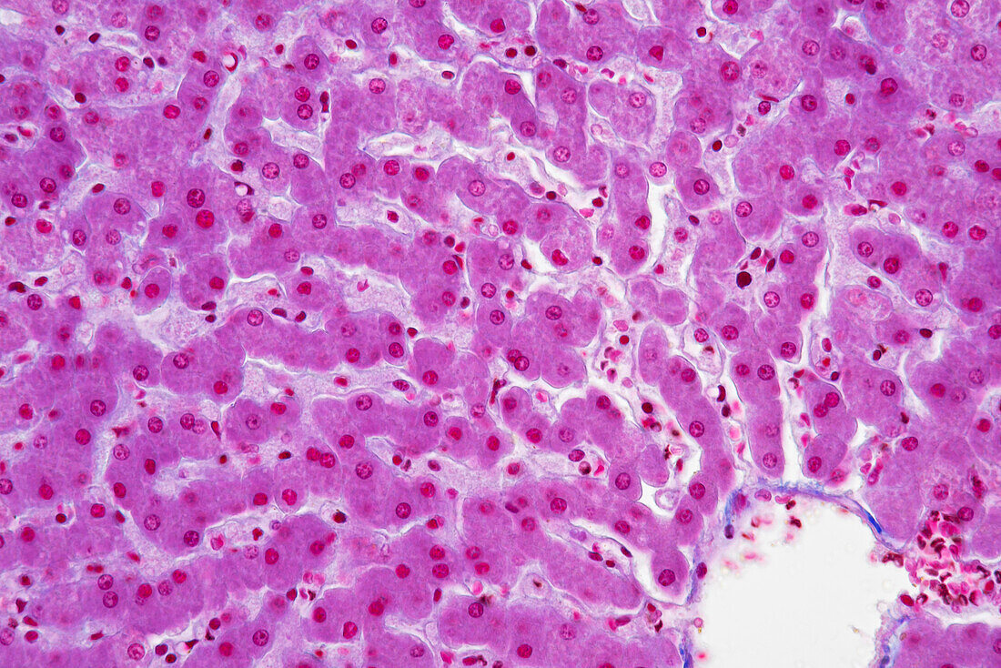 Liver lobule, light micrograph