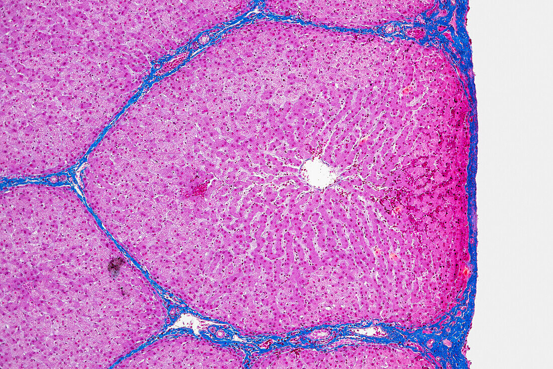 Liver lobules, light micrograph