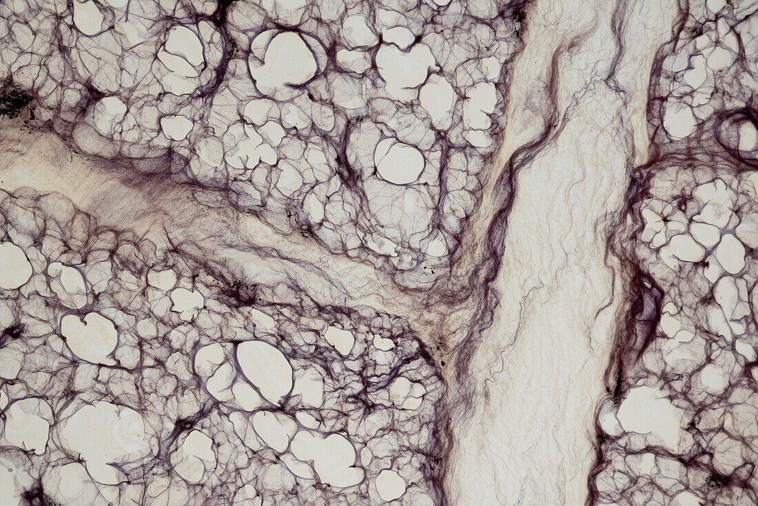 Lung, light micrograph