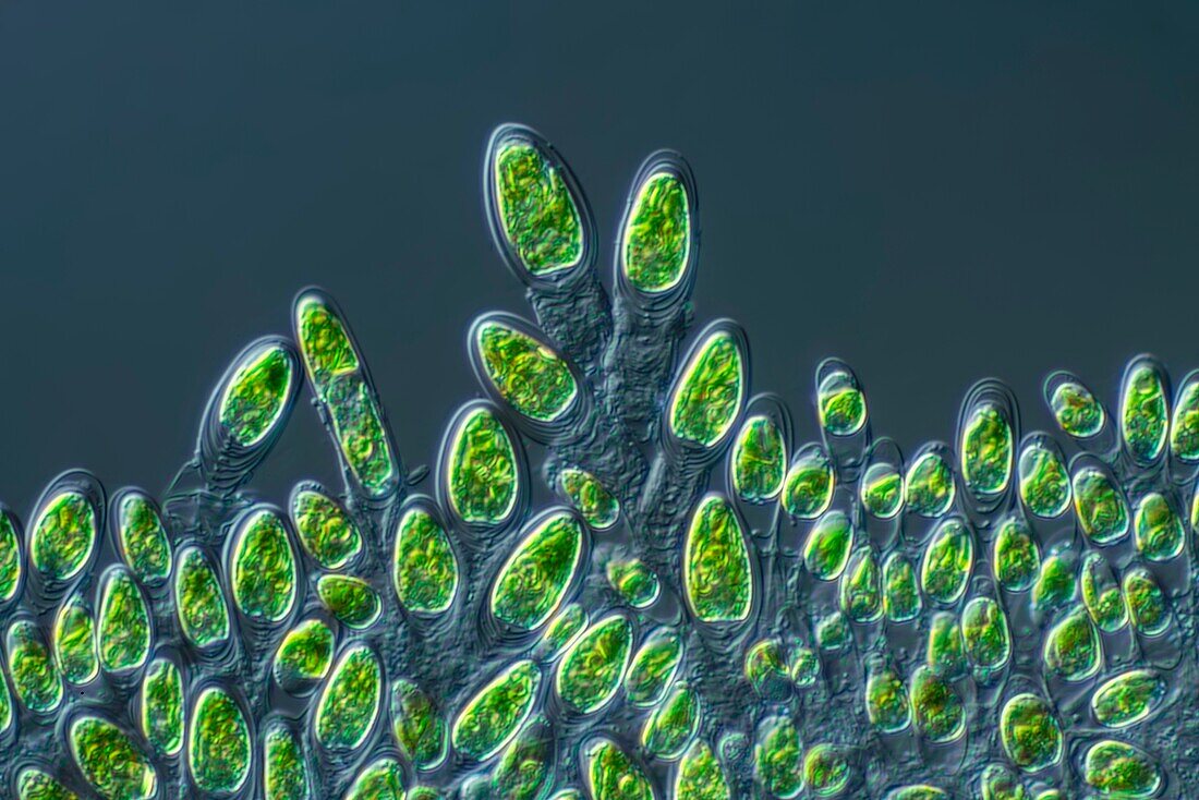Tetraselmis green algae, light micrograph
