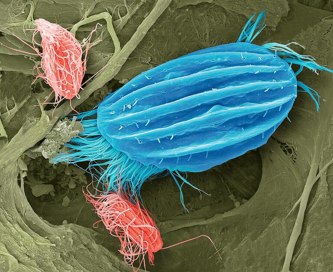 Ciliate protozoa, SEM