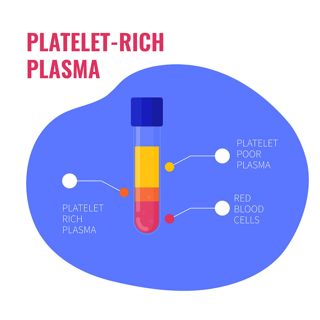 Platelet-rich plasma composition, conceptual illustration