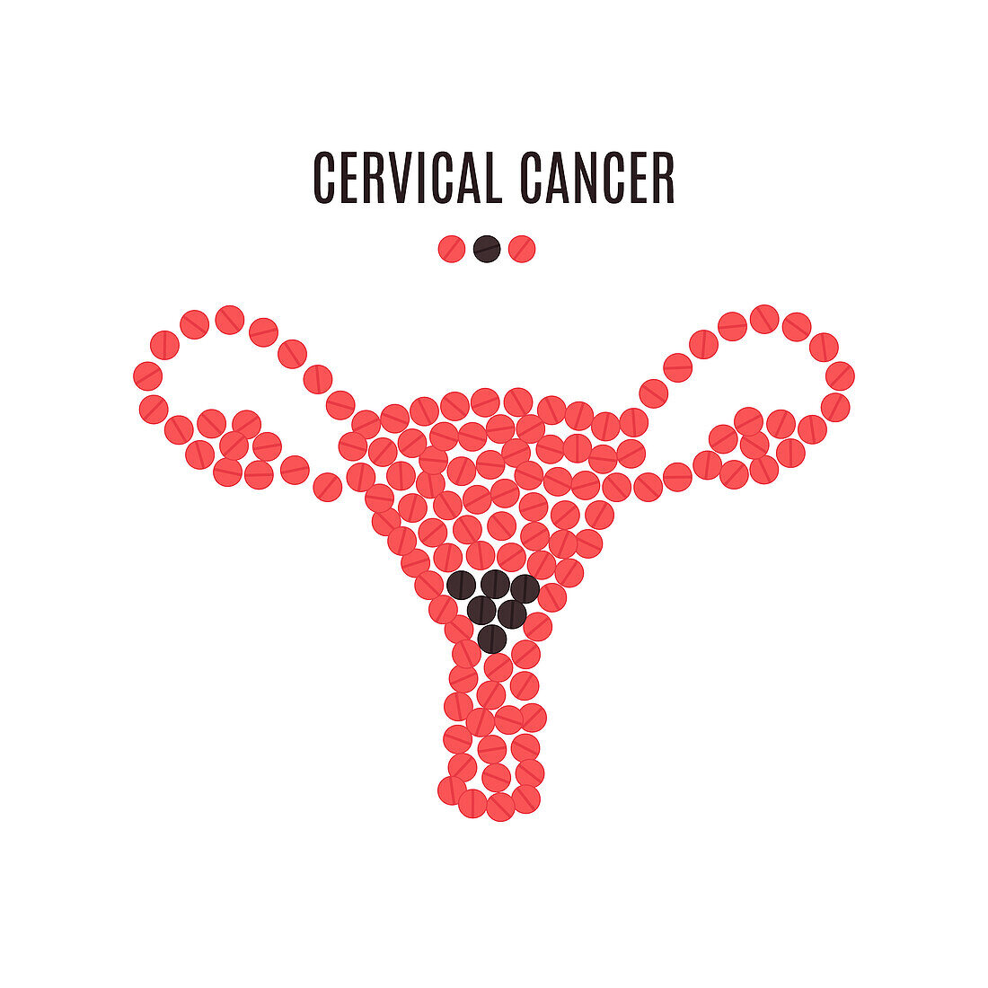 Cervical cancer, conceptual illustration