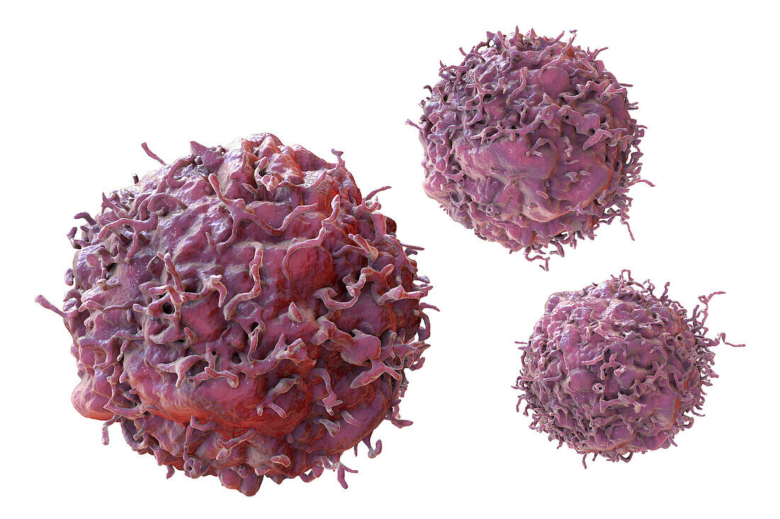 Cancer cells, illustration