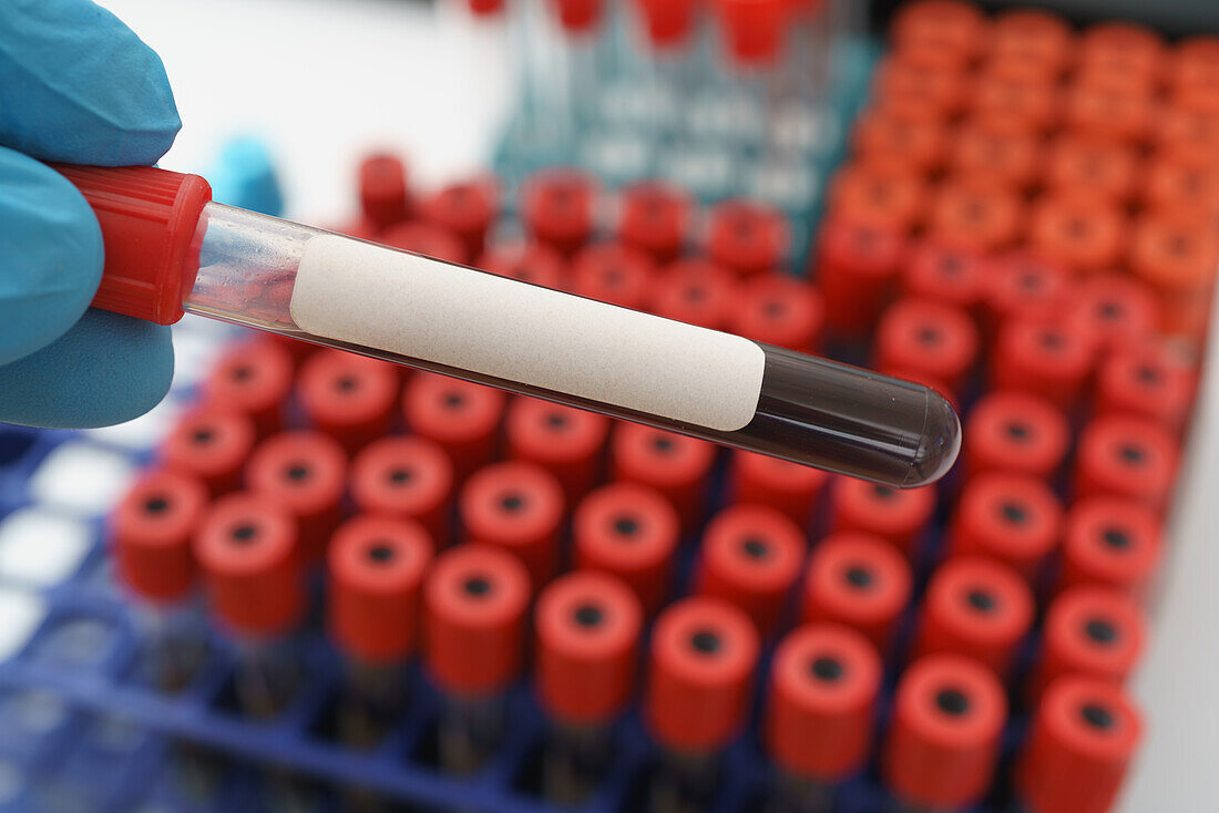 Test tube with a blood sample