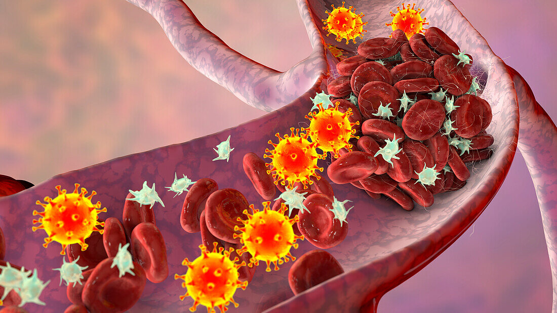 COVID-19 virus and activated platelets, illustration