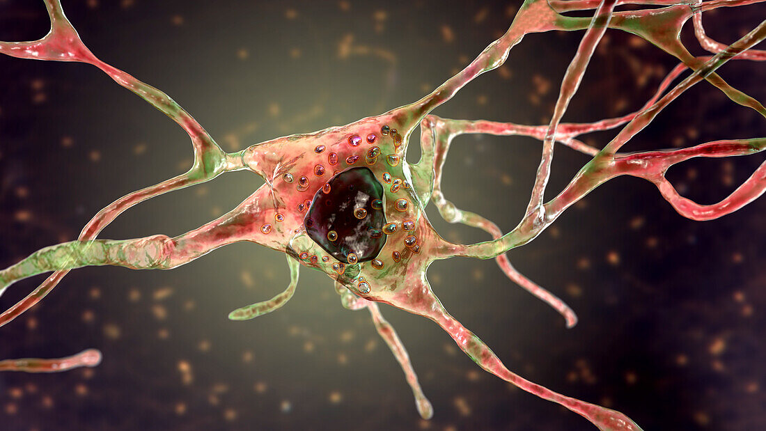 Neuron with lysosomes, illustration