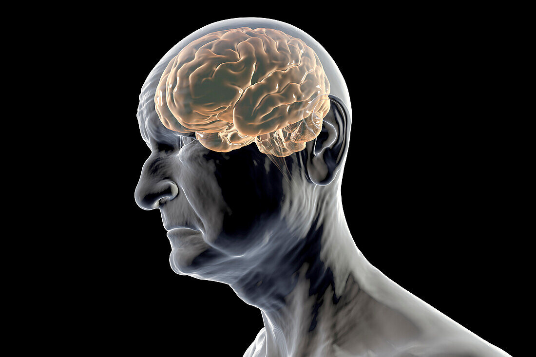Old man's brain, illustration
