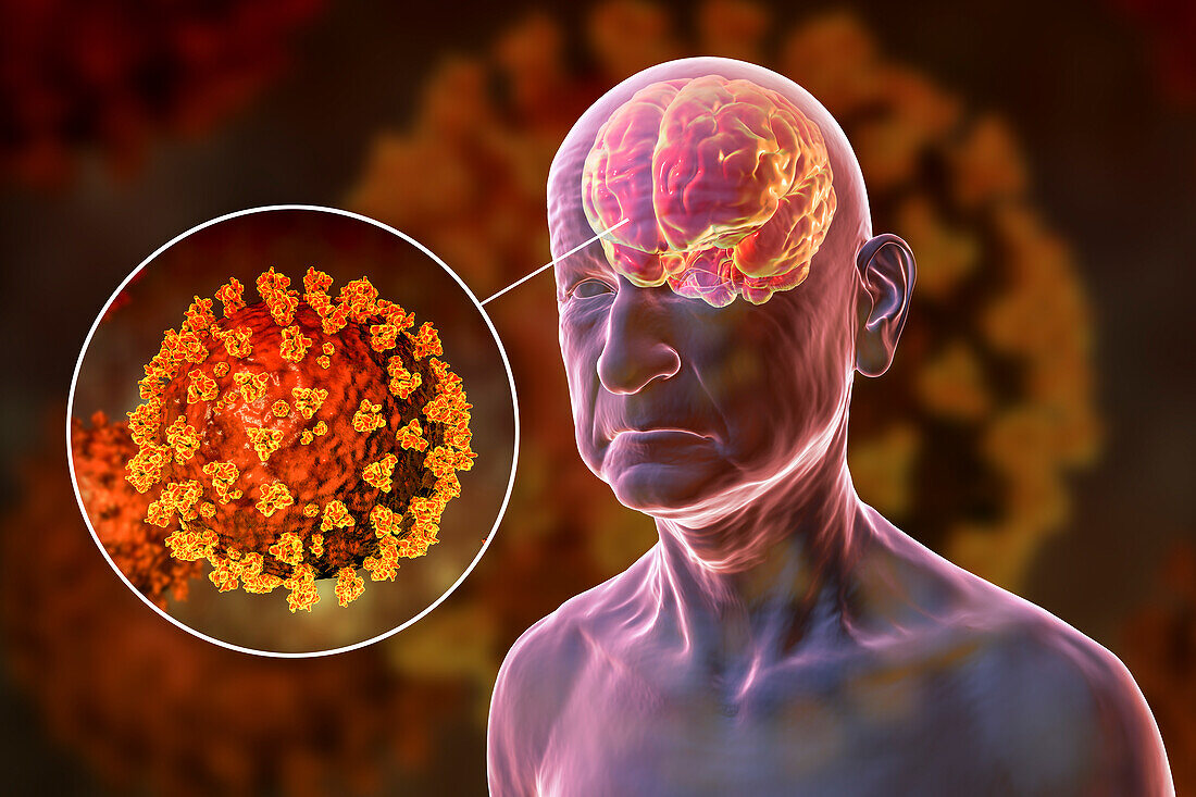 Covid-19 and dementia, illustration