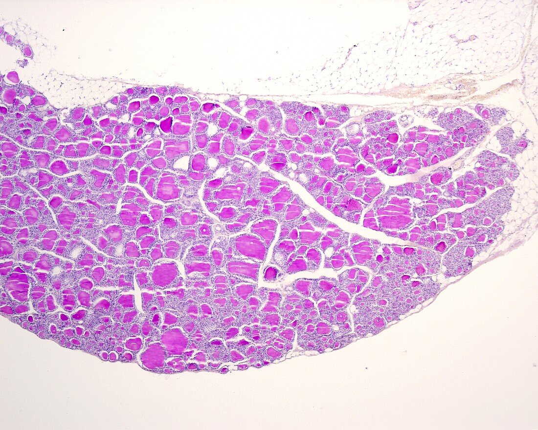 Rabbit thyroid gland, light micrograph