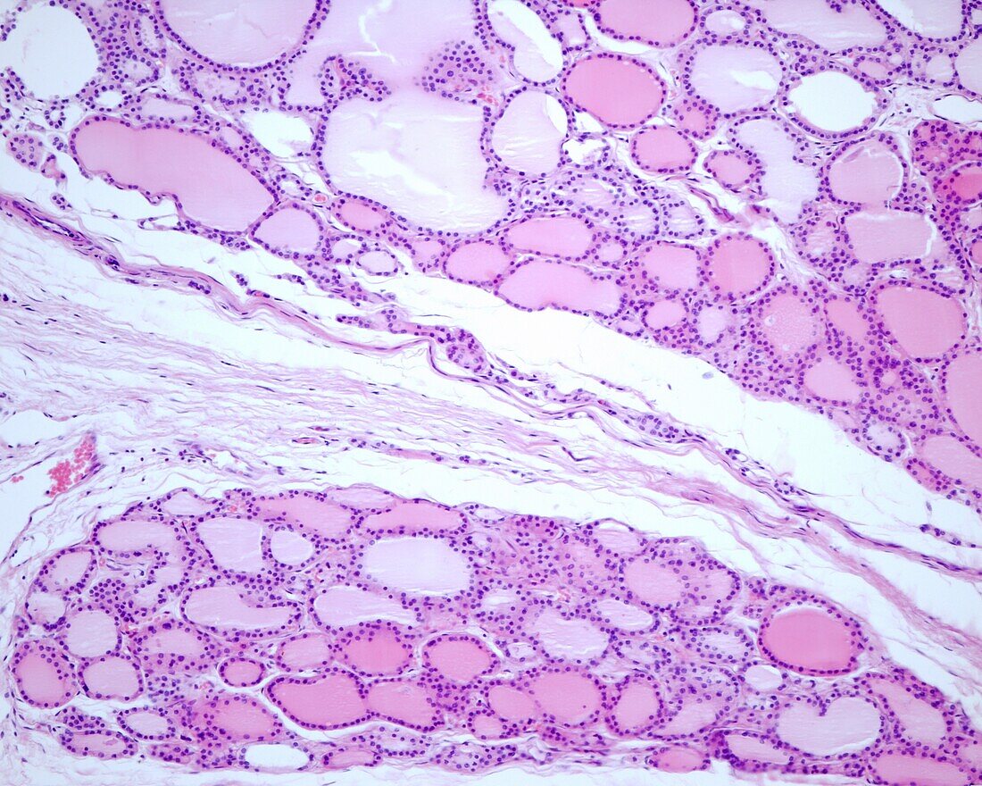 Human thyroid gland, light micrograph