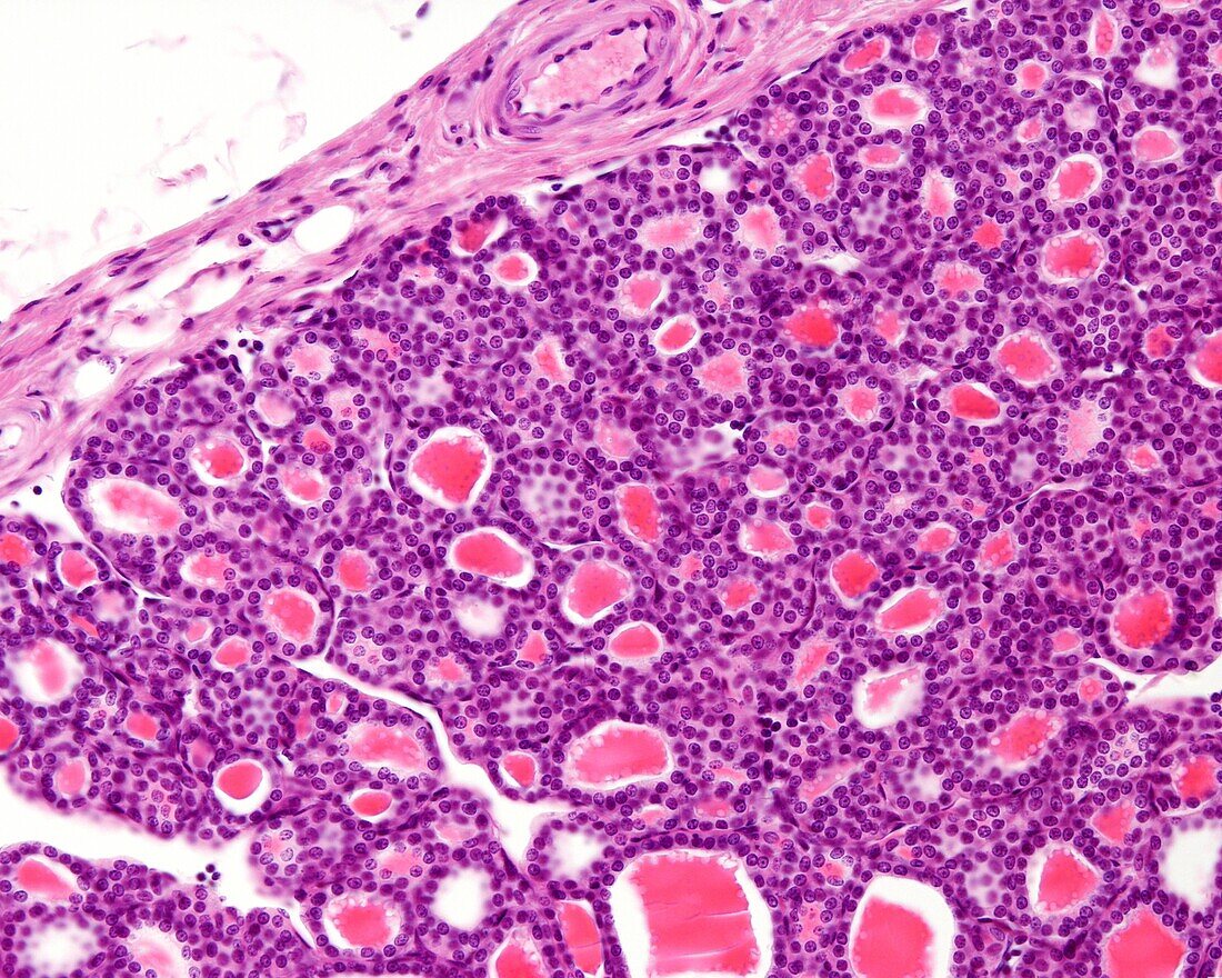 Thyroid gland capsule, light micrograph
