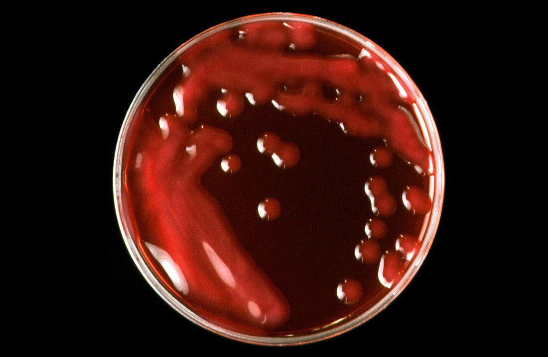 Petri dish culture of Klebsiella aerogenes