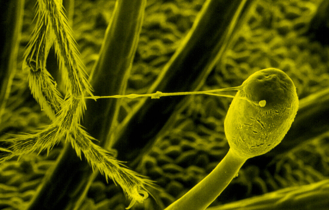 SEM of fly caught by Sundew plant