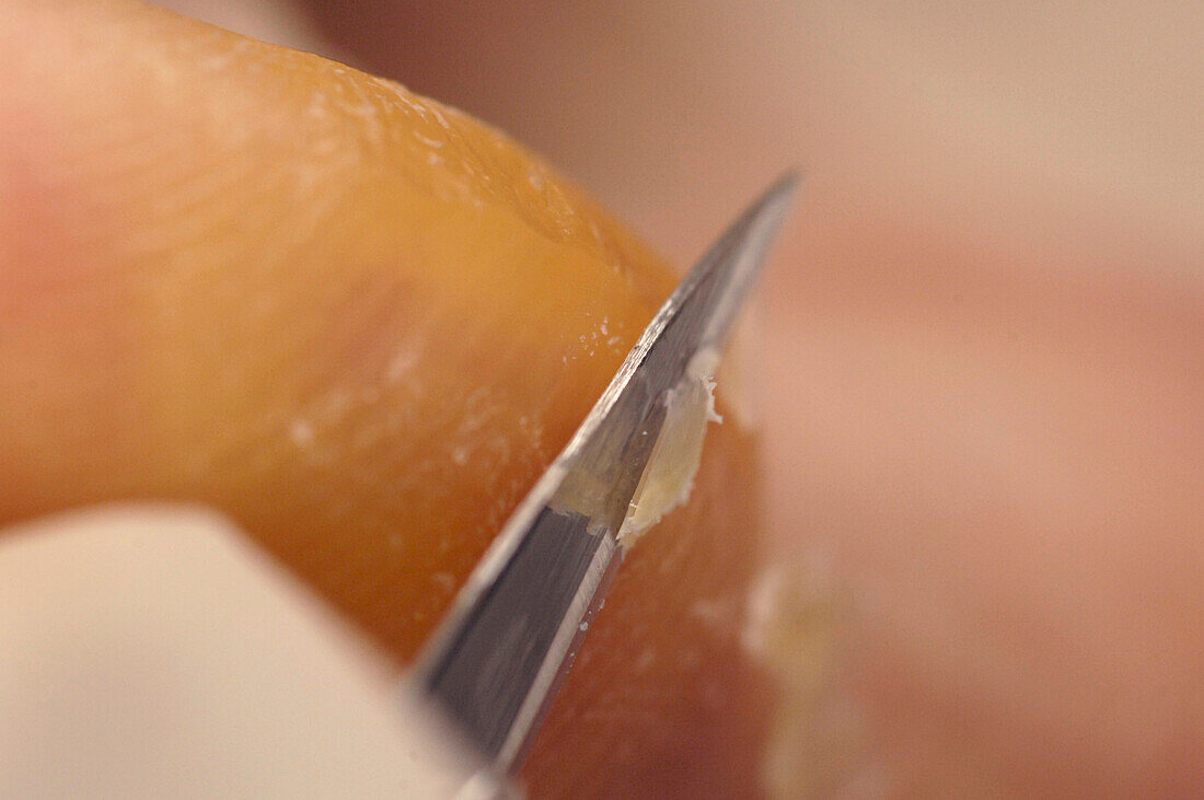 Chiropodist removing hardened skin