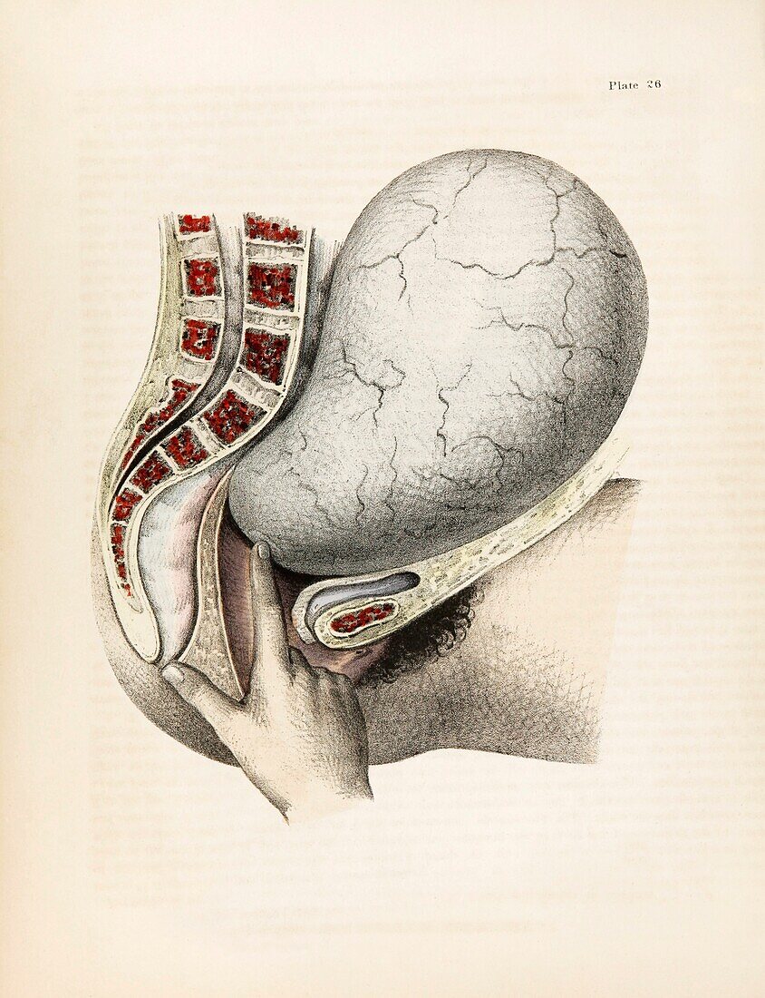Full term uterus, 19th century illustration