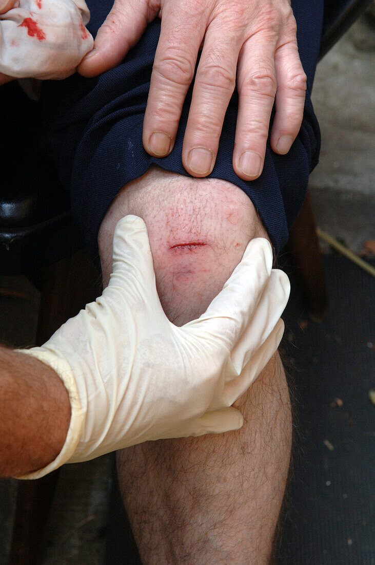 Paramedic tending to a cut knee