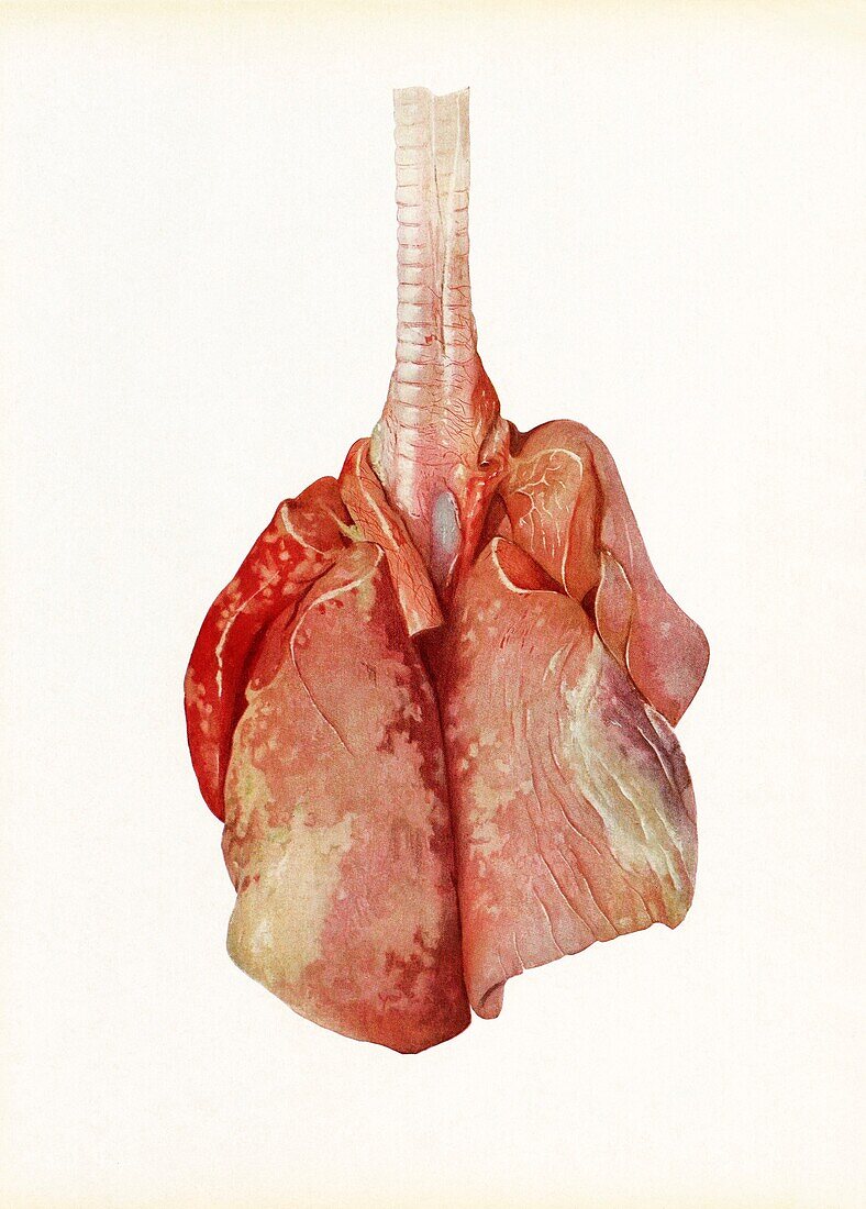 Lungs of a dog gassed with chlorine, illustration