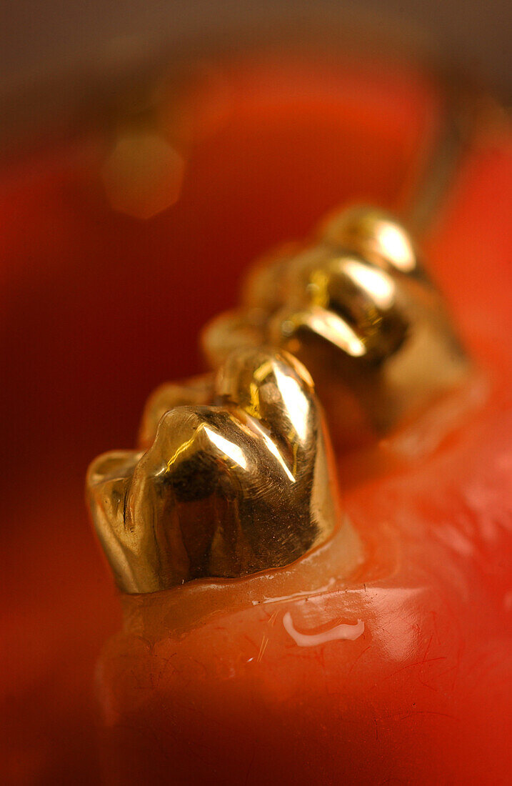 Gold teeth
