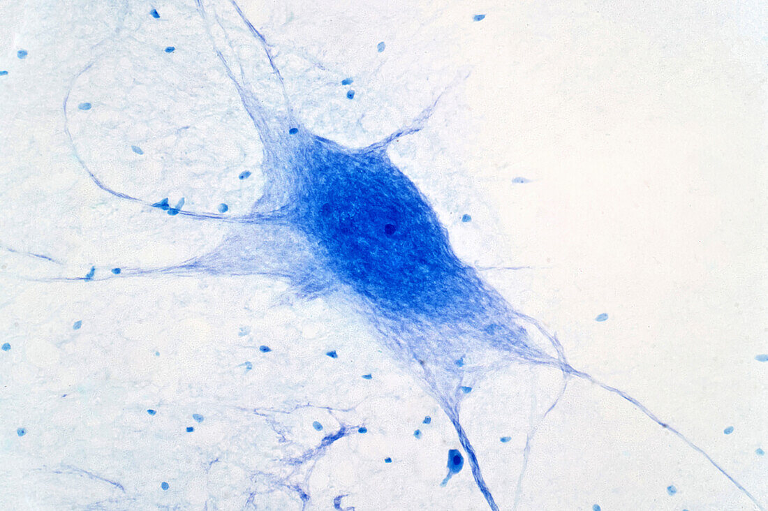 Neuron cells, light micrograph