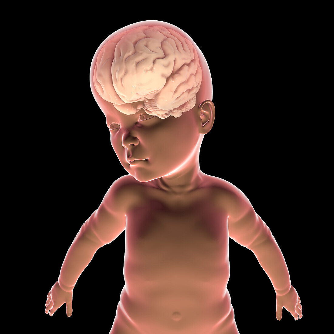 Child with macrocephaly and enlarged brain, illustration