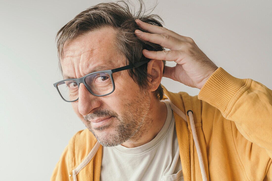 Man worried about hair loss