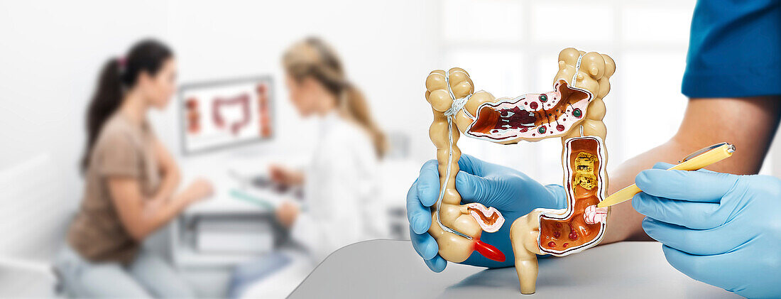 Intestinal disorders, composite image