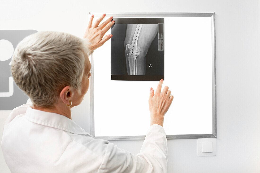 Doctor examining knee X-ray