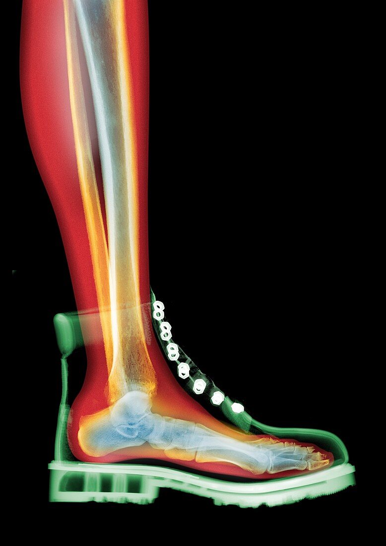 Lace-up boot MRI style, X-ray