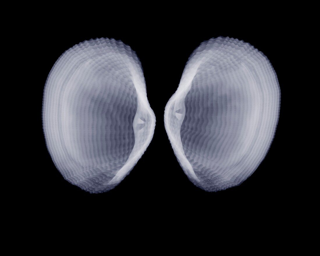 Shells, X-ray